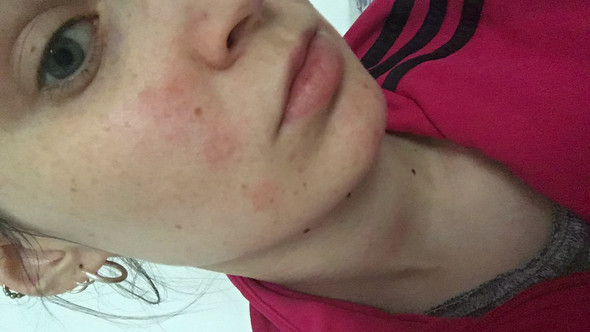 27+ Pickel Ausdrücken Oder Nicht Gutefrage Images