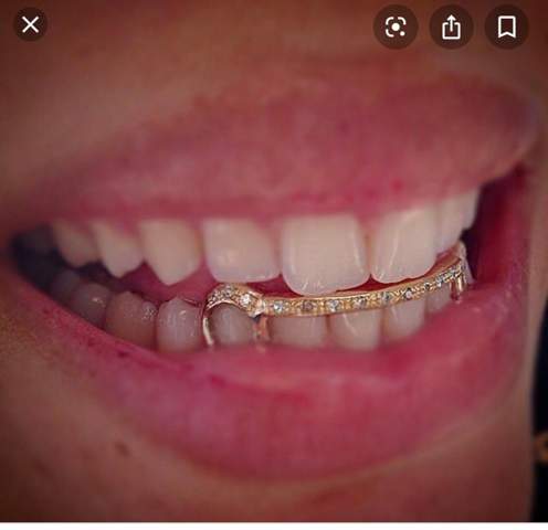 Grillz anfertigen lassen kosten Grillz anfertigen lassen kosten