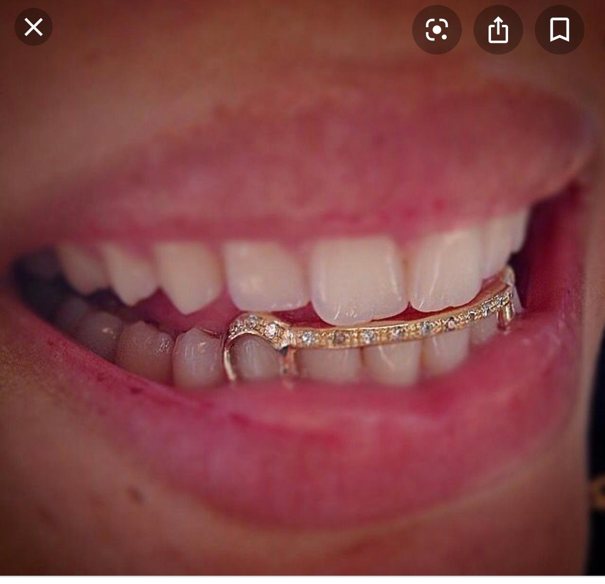 Wie viel kosten grillz