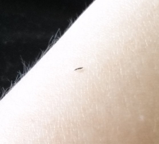 Was Sind Das Fur Kleine Schwarze Tiere