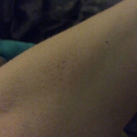 Hier ein bild - (Gesundheit, Haut)