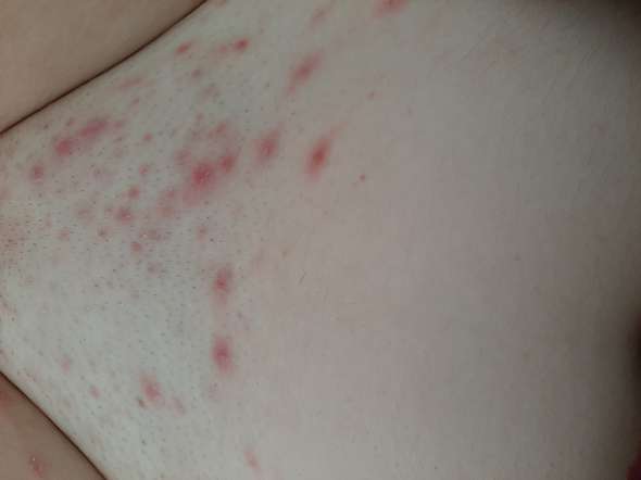 was sind das fur punkte im intimbereich