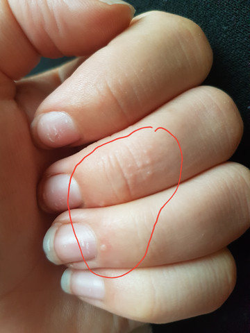 Kratze Die Meistgelesenen Fragen Kratze Die Meistgelesenen Fragen