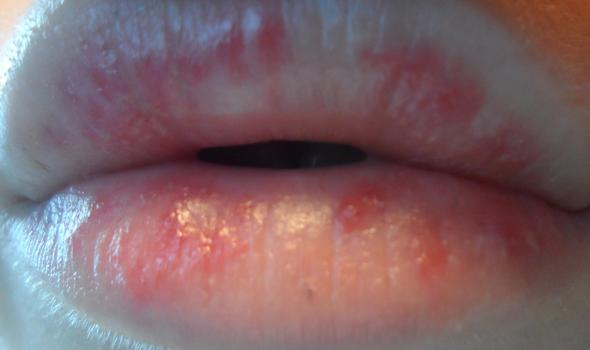 Rote Lippen Blasen