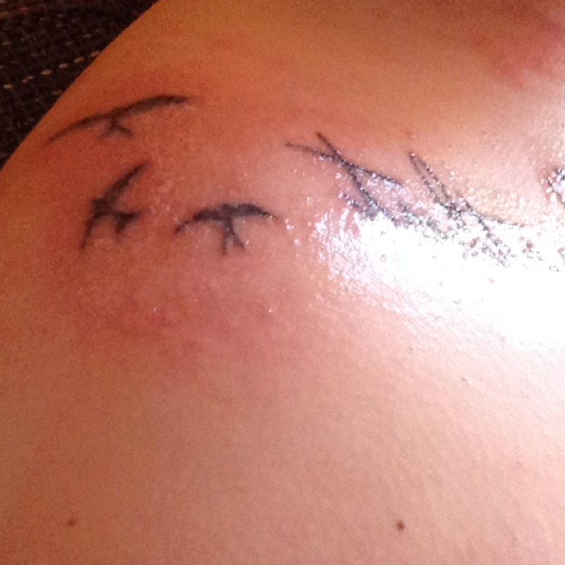 Was sind das für rote pinkelchen um mein neues tattoo? (Pickel, Juckreiz)