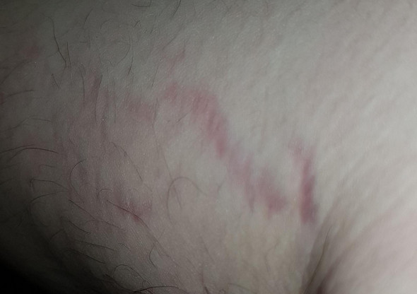 Rote Streifen Die Meistgelesenen Fragen Rote Streifen Die Meistgelesenen Fragen