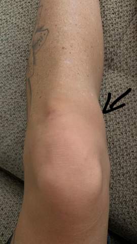 Was Sind Das Fur Schmerzen Unterhalb Vom Knie Gesundheit Und Medizin Knieschmerzen Was Sind Das Fur Schmerzen Unterhalb Vom Knie Gesundheit Und Medizin Knieschmerzen