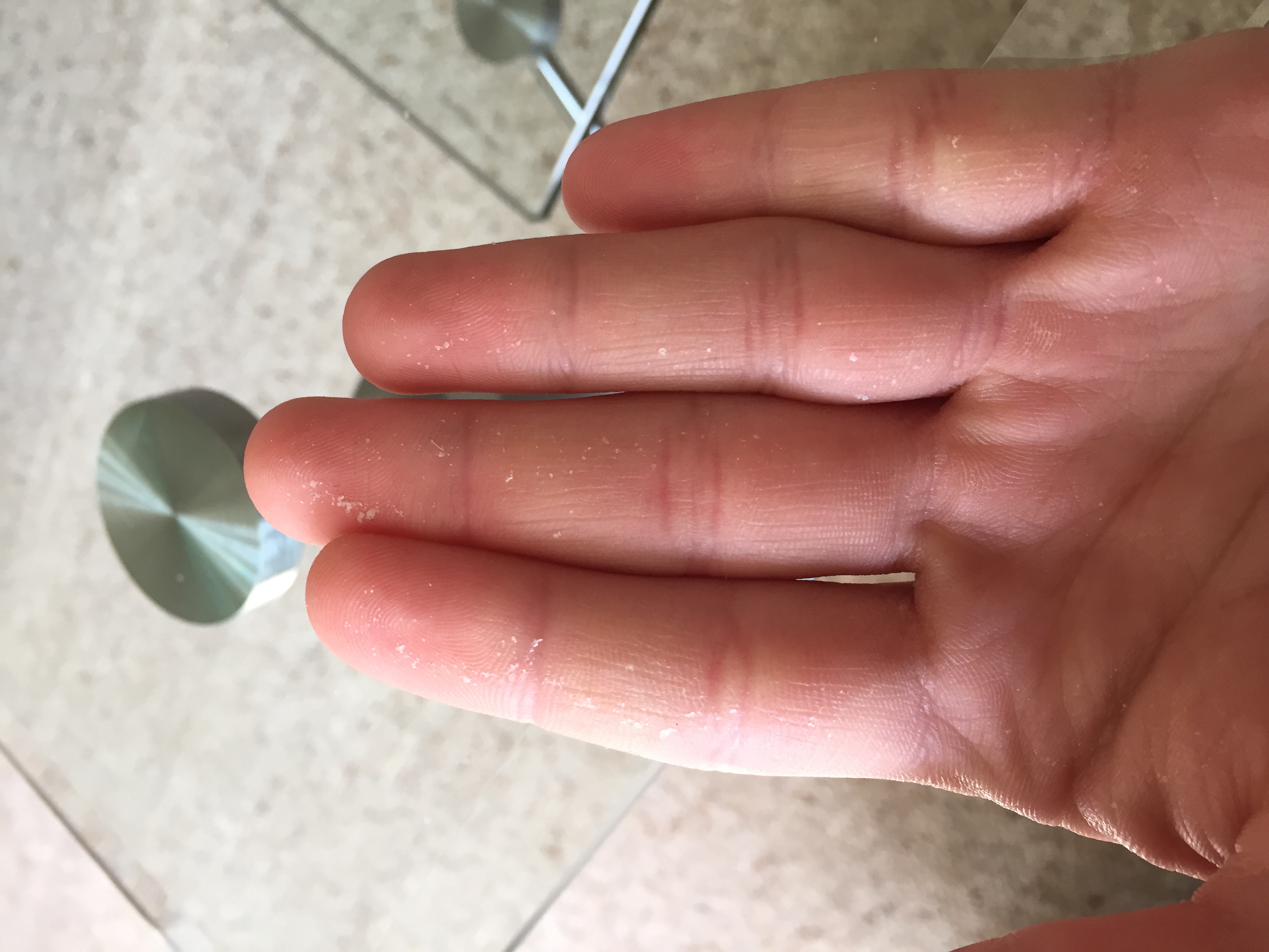 Was sind das für Schuppen und was kann ich dagegen tun? (Gesundheit