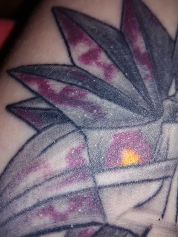 Was Sind Das Fur Seltsame Pickel Auf Meinem Tattoo Gesundheit Und Medizin Haut Pflege