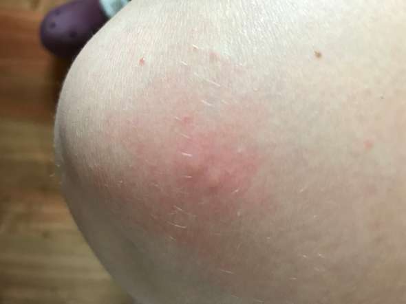 Bisse Die Meistgelesenen Fragen