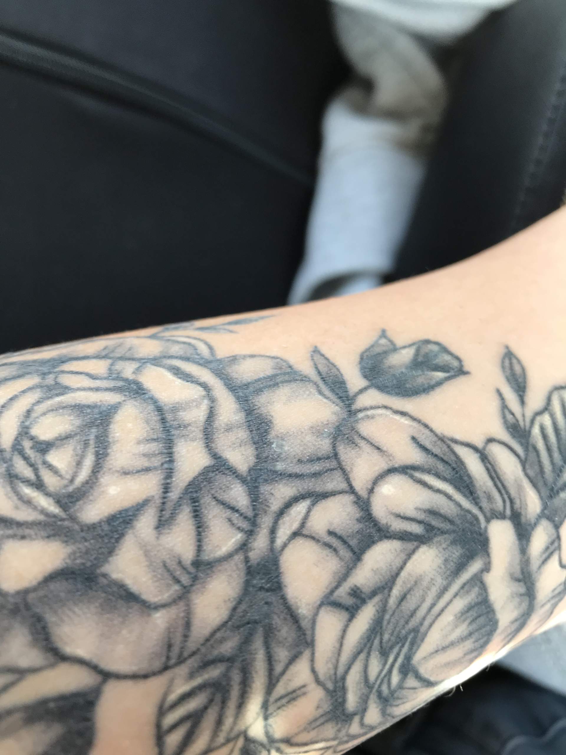Was sind das für weise Punkte im meinen Tattoo? (Medizin, Haut, Kunst) Was sind das für weise Punkte im meinen Tattoo? (Medizin, Haut, Kunst)