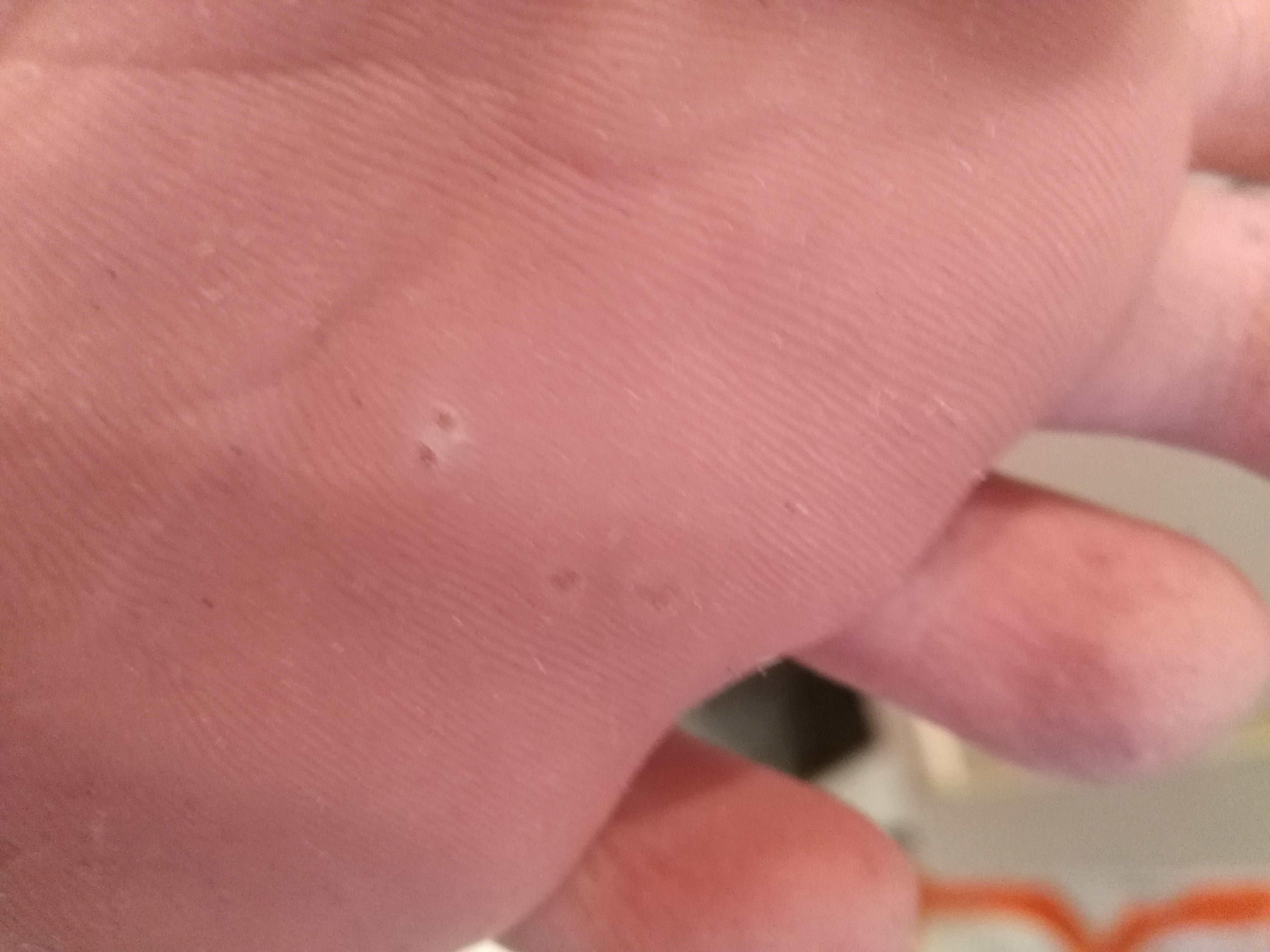 Was Sind Das Fur Weisse Locher In Meinem Fuss Beauty Fusse Hygiene Was Sind Das Fur Weisse Locher In Meinem Fuss Beauty Fusse Hygiene