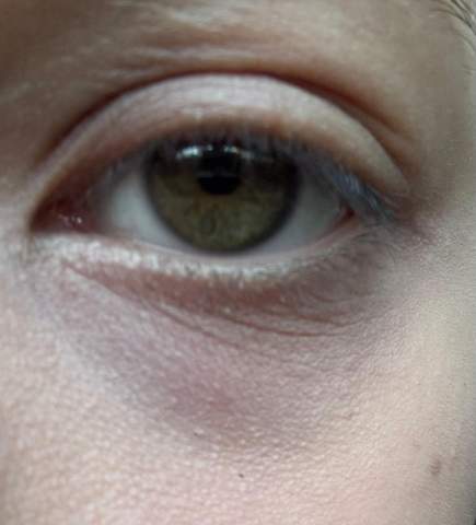 - (Aussehen, Haut, Augen)