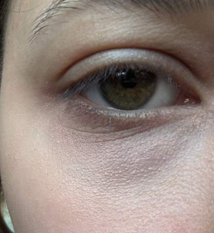 - (Aussehen, Haut, Augen)