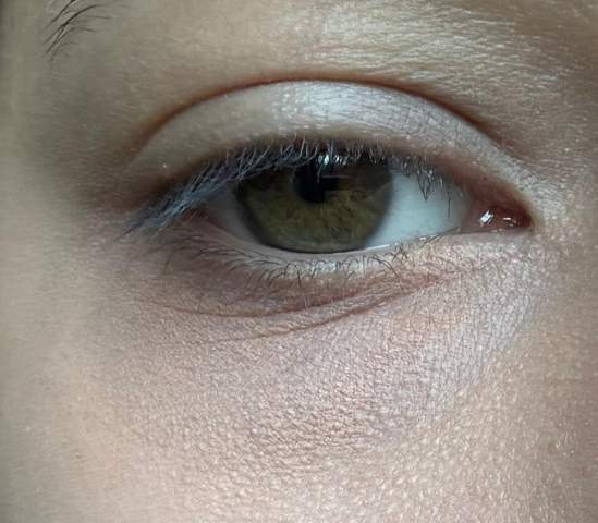 - (Aussehen, Haut, Augen)