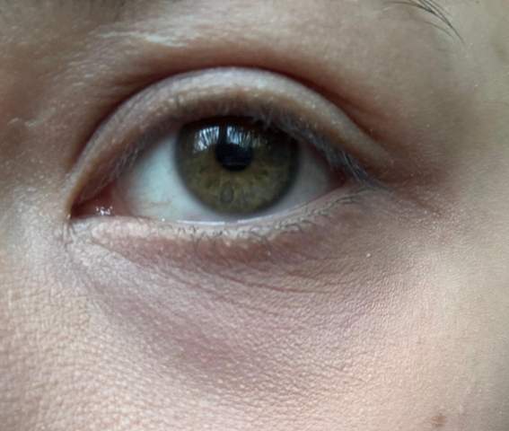 - (Aussehen, Haut, Augen)