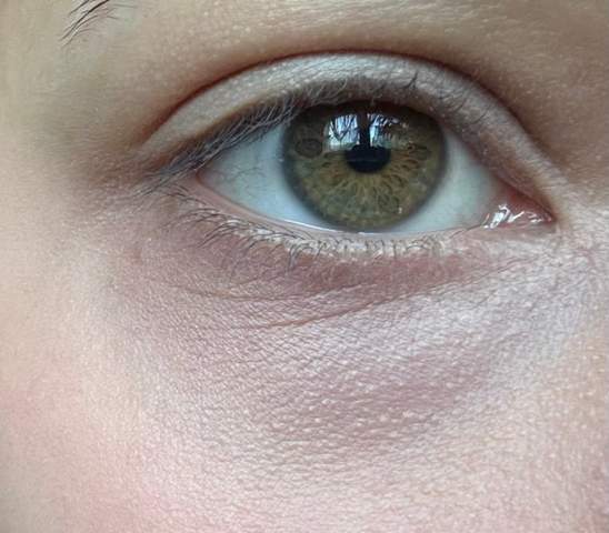 - (Aussehen, Haut, Augen)