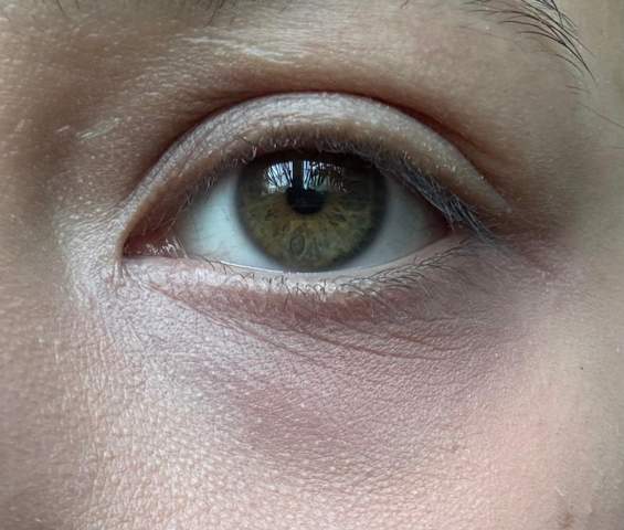 - (Aussehen, Haut, Augen)