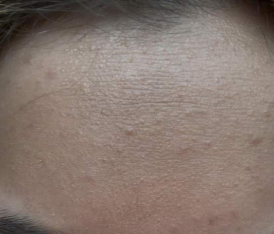 - (Aussehen, Haut, Augen)