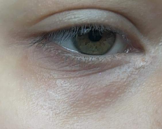 - (Aussehen, Haut, Augen)