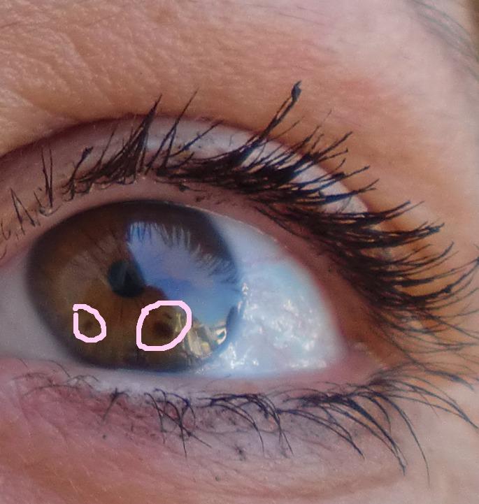 Was sind die braunen Flecken im Auge? (Augen, braun)
