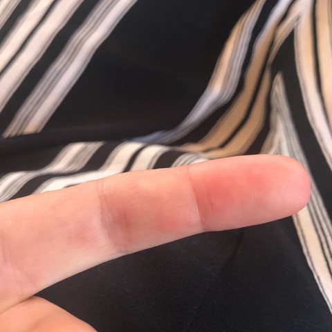 Finger innen - (Haut, Pickel, Hautpflege)