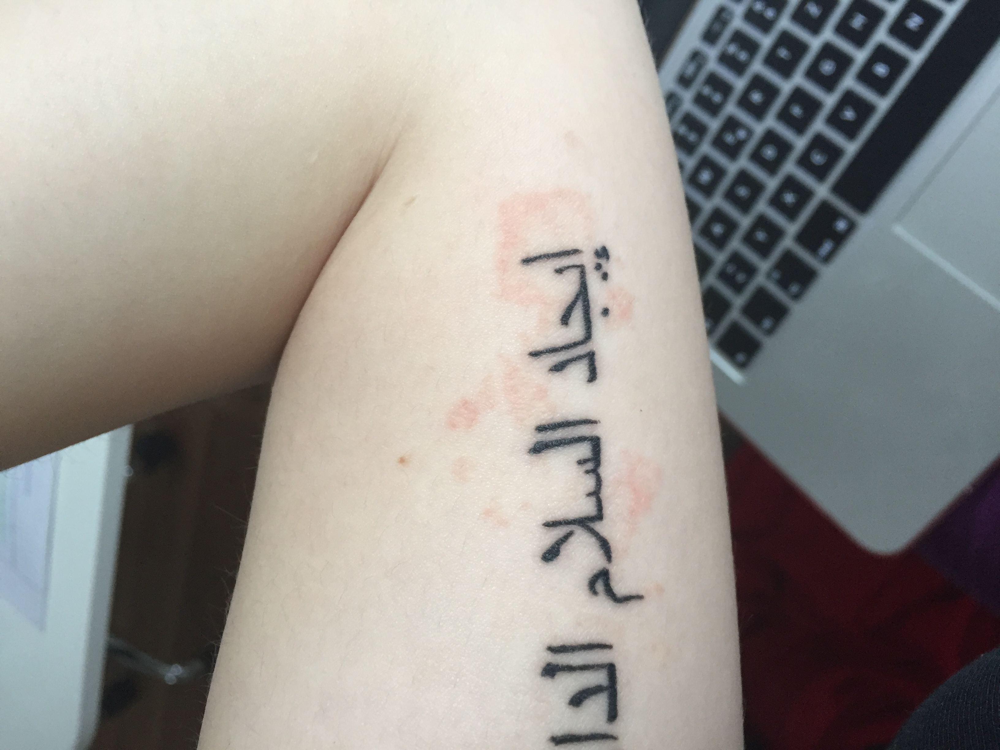 Was stimmt nicht mit meinem Tattoo? (Entzündung)