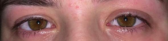 Schwarzkmmell Bei Magendarmproblemen Mehr Netdoktor Schwarzkmmell Bei Magendarmproblemen Mehr Netdoktor