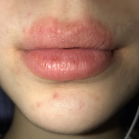 Rand um lippen roter Lippe wird