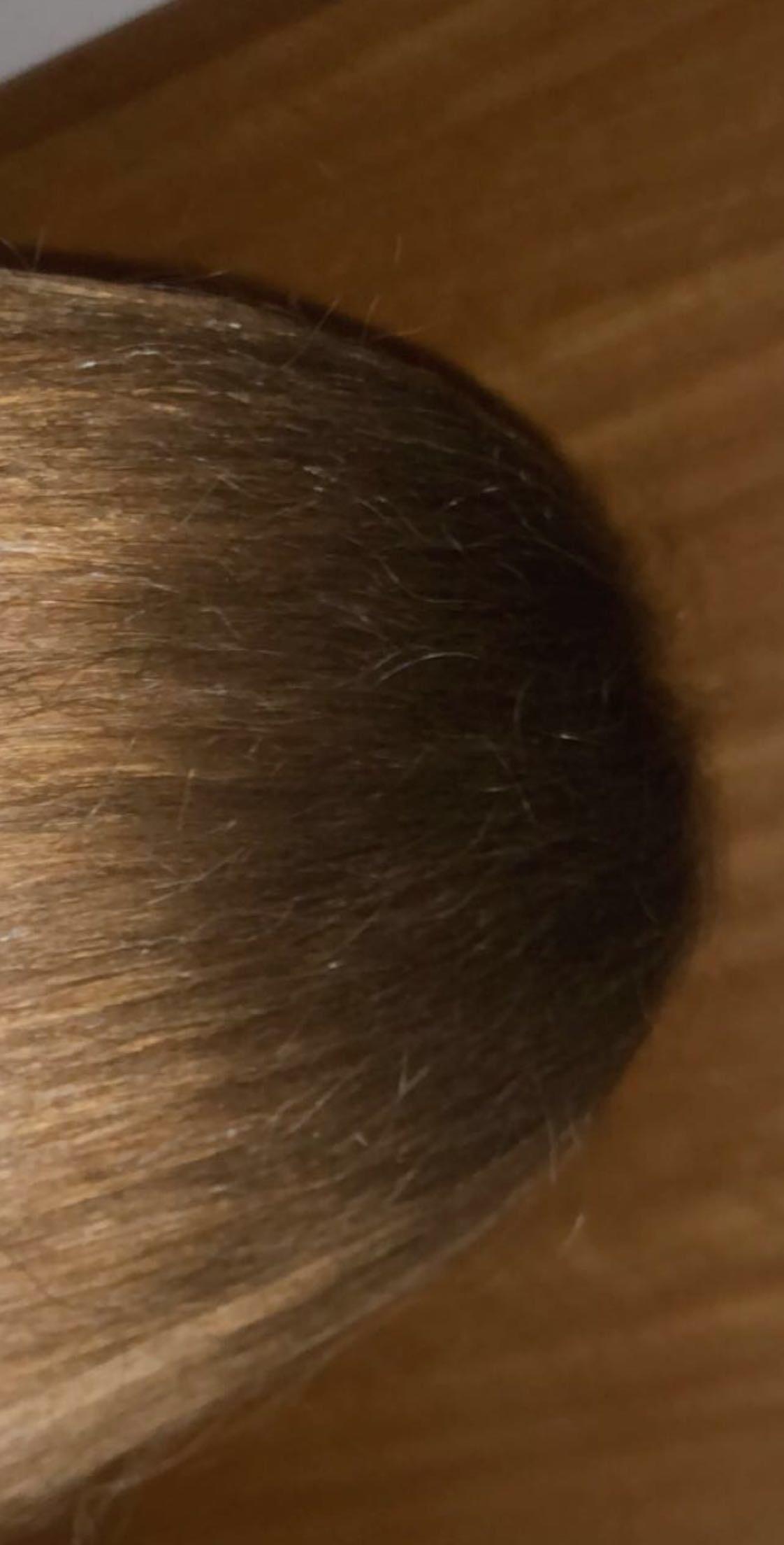 extrem trockenes haar am ansatz