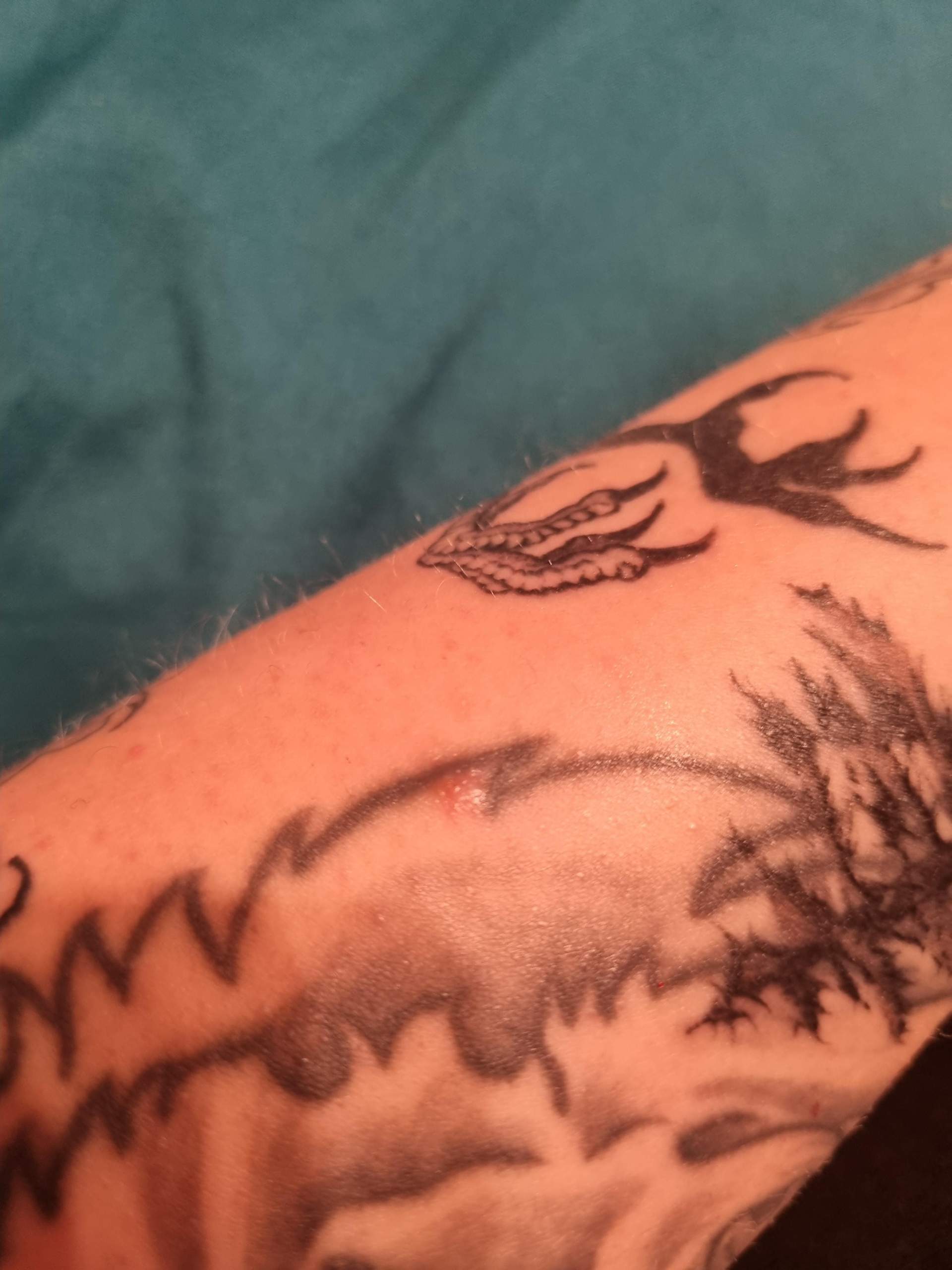 Was tun bei tattoo kruste? (Tattoopflege)