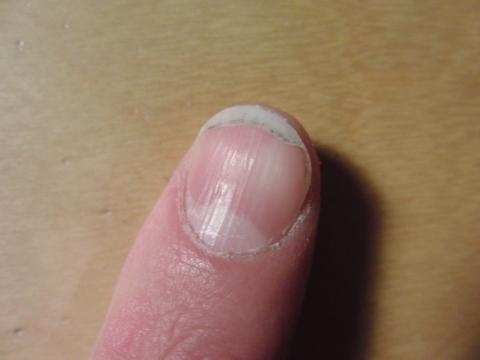  - (Fingernägel, trockene Haut, Nagelpflege)