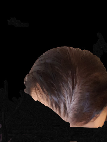 was tun bei undichtem haar manner