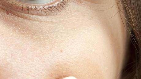 Was Tun Gegen Diese Erscheinungen Unter Dem Auge Gesundheit Haut Pflege