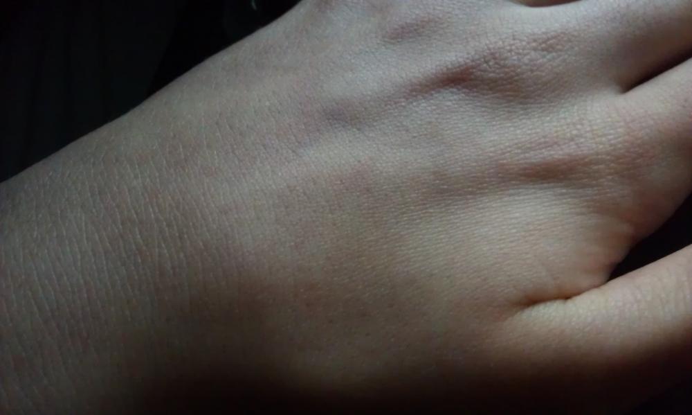 Was tun gegen "faltige" Hände mit 16? (Und NEIN, sie sind nicht trocken) (Haut, Hand, Hautpflege)