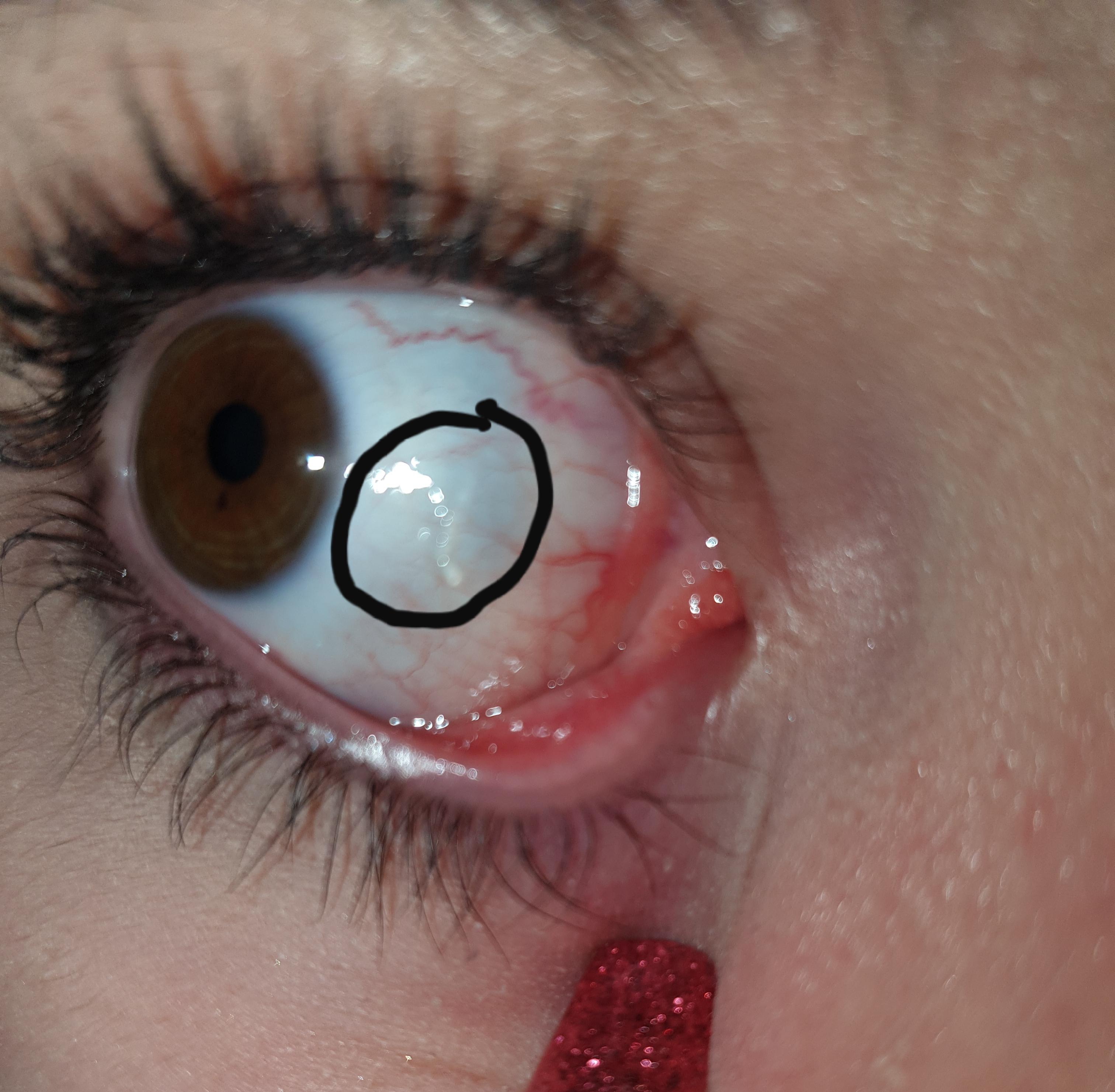 Was Tun Gegen Komisches Etwas Im Auge Gesundheit Medizin Augen Was Tun Gegen Komisches Etwas Im Auge Gesundheit Medizin Augen