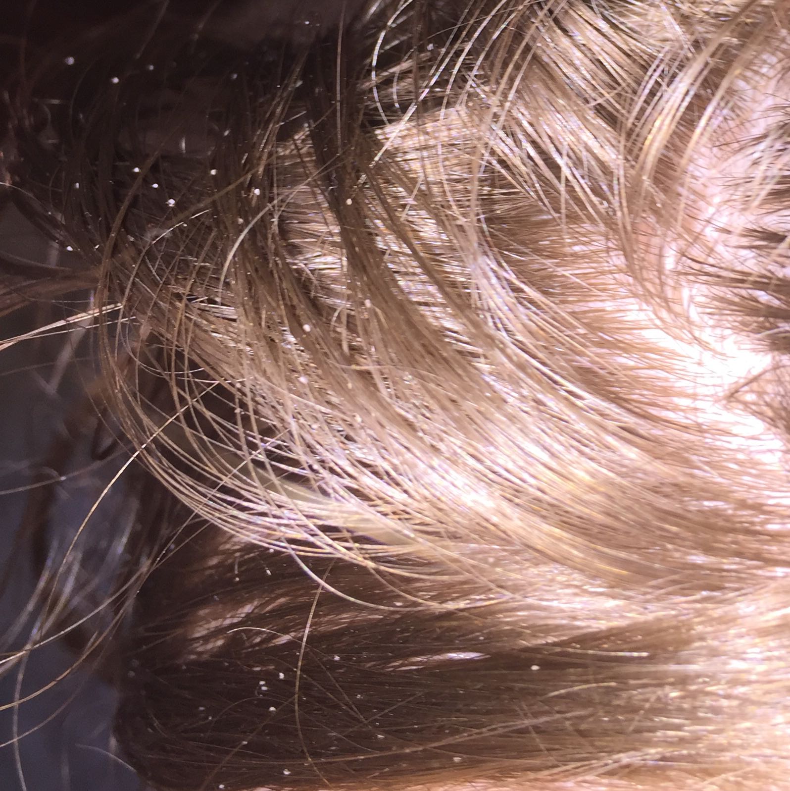 haare shampoo haarpflege