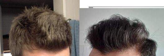 Was Tun Gegen Strohiges Und Trockenes Haar Haare Beauty Frisur