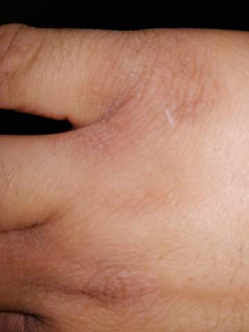 Was Tun Gegen Trockene Hand Haut Gesundheit Und Medizin Gesundheit Beauty Was Tun Gegen Trockene Hand Haut Gesundheit Und Medizin Gesundheit Beauty