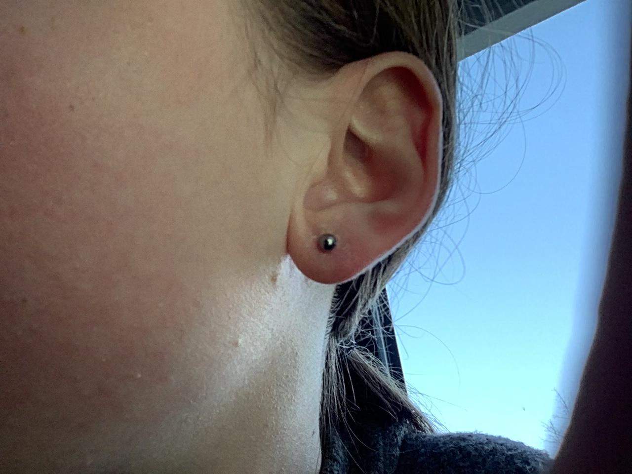 Was tun? Ohrloch entzündet? (Frauen, Schmerzen, Entzündung)