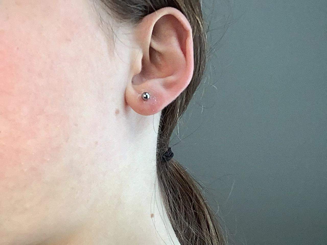 Was tun? Ohrloch entzündet? (Frauen, Schmerzen, Entzündung)