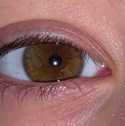 Was War Das In Meinem Auge Gesundheit Und Medizin Augen Was War Das In Meinem Auge Gesundheit Und Medizin Augen