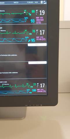 Was zeigt der Monitor an? (Krankenhaus)? (Computer, Technik)