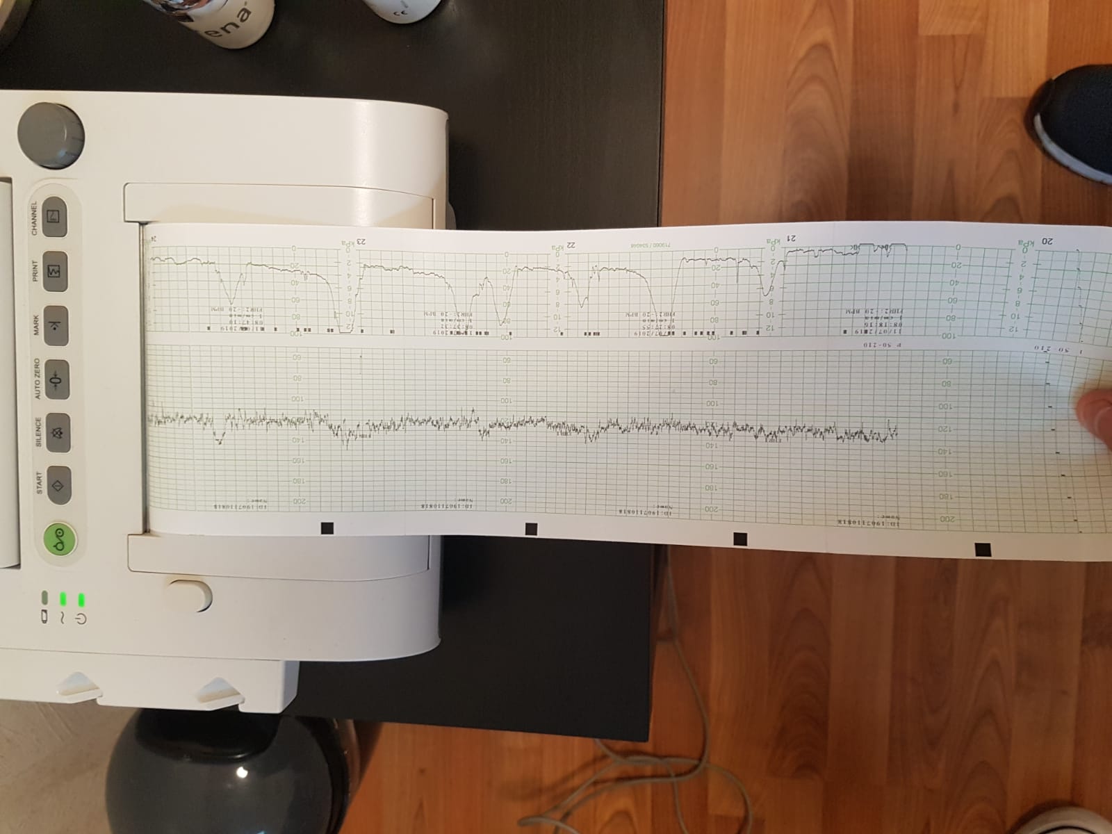 Wehen Beim Ctg Aber Keine Schmerzen Schwangerschaft Geburt Stichtag Wehen Beim Ctg Aber Keine Schmerzen Schwangerschaft Geburt Stichtag