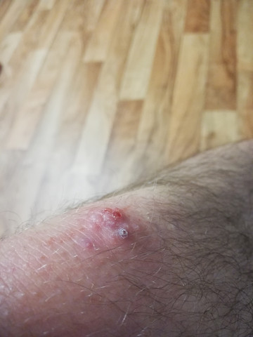 Berührung am knie bedeutung Berührung am knie bedeutung