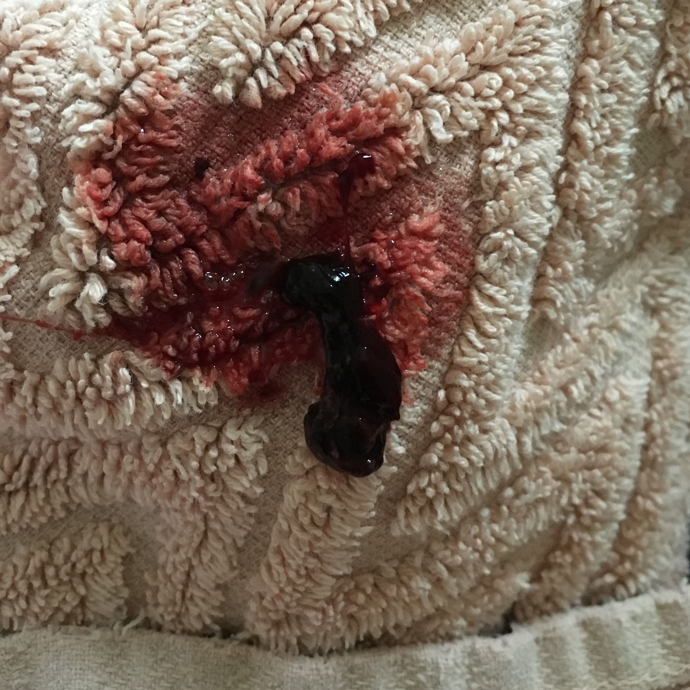 Blut, Blut, Blut! Klapperstrauß