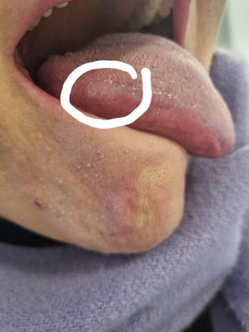 Weiß jemand was das auf der Zunge ist?