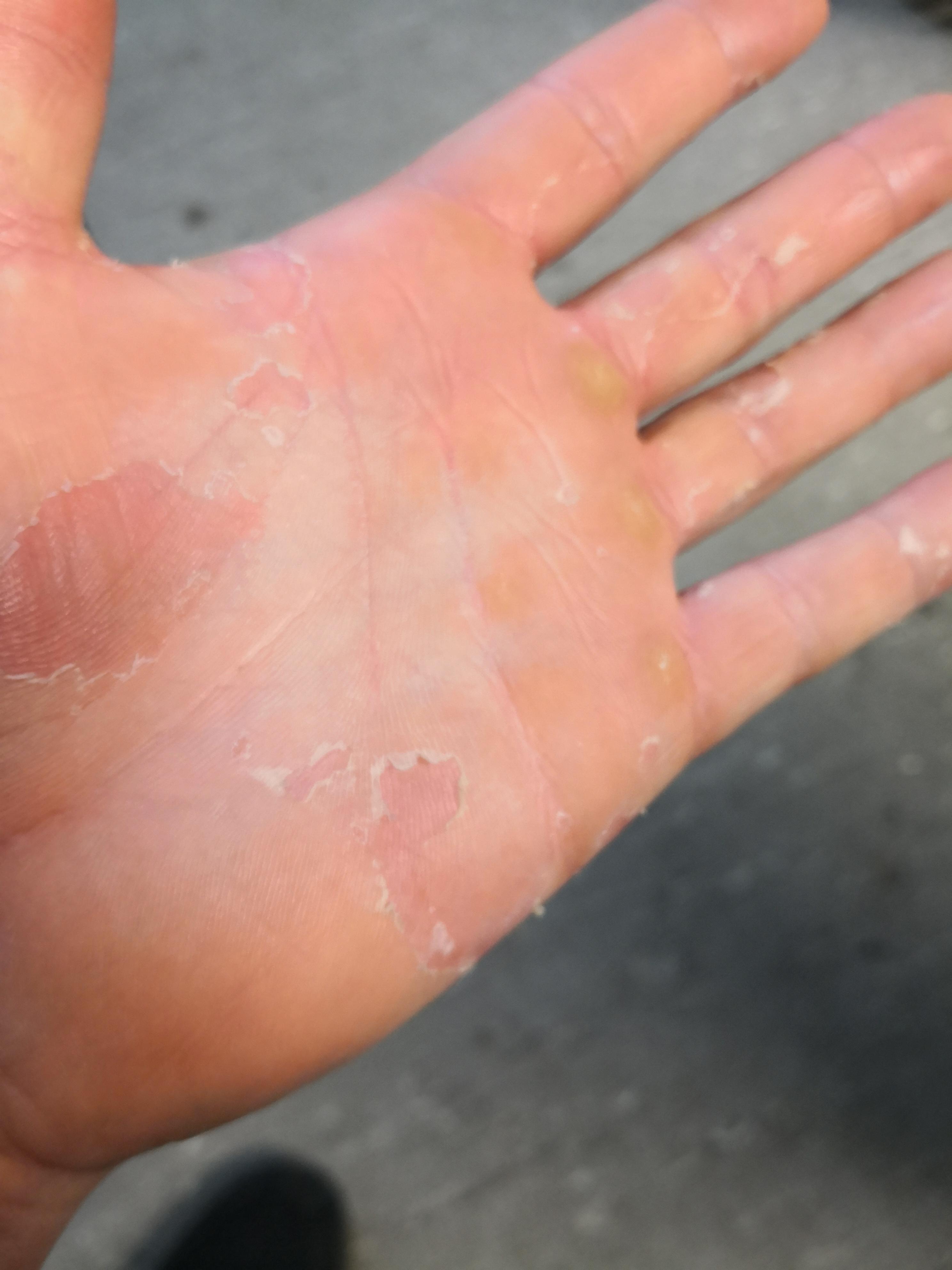 Weiß jemand ob das ein Pilz ist? (Hand, Pilze)