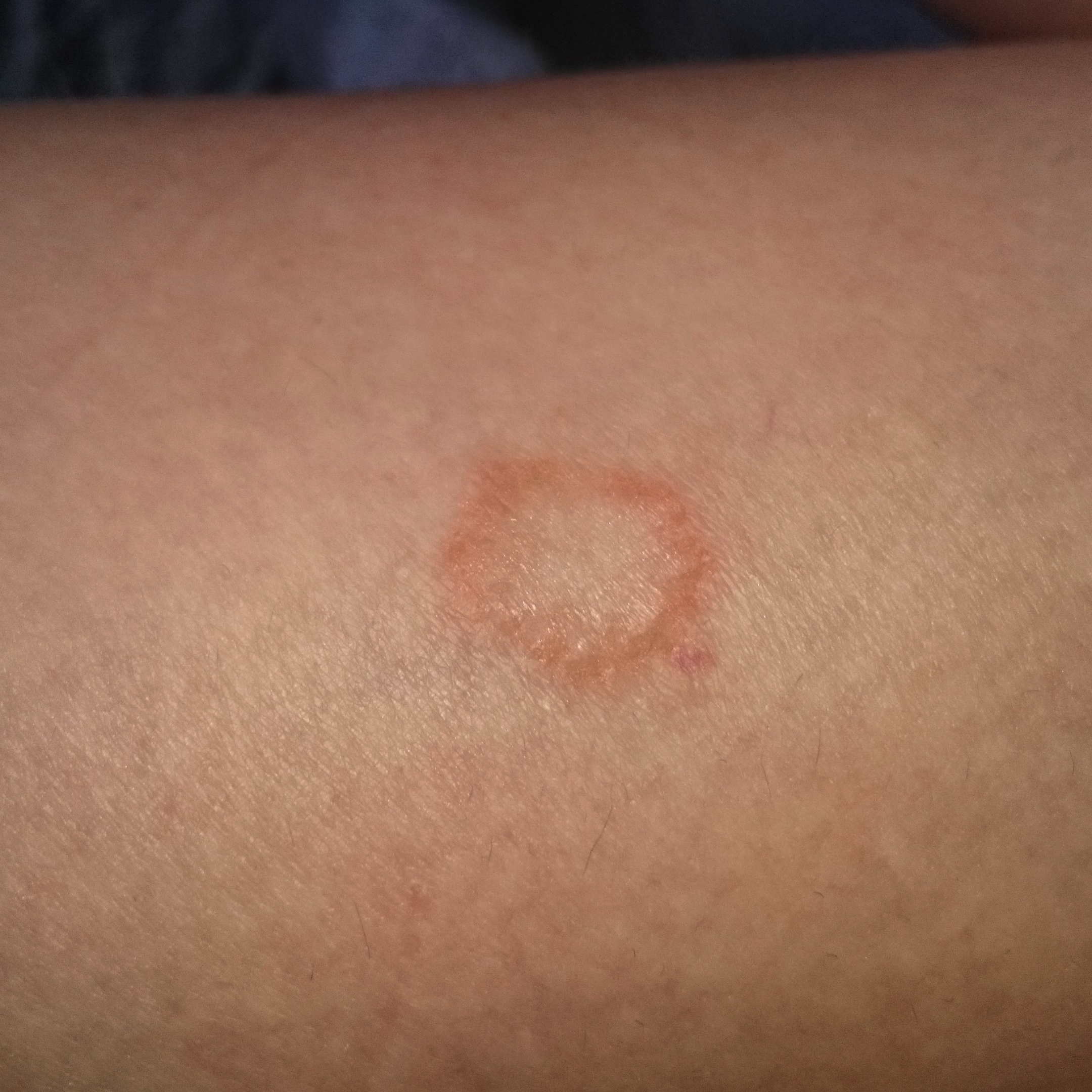 Weiß jemand was das ist? Da ich momentan keine Zeit für einen Weiß jemand was das ist? Da ich momentan keine Zeit für einen