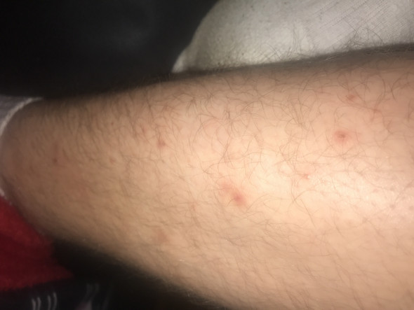 Uniklinik Leipzig Angehriger Infiziert Patienten